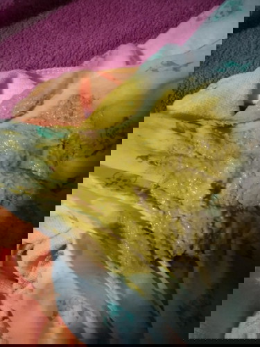 ใช่ถ่ายเหลว ถ่ายเป็นน้ำไหมคะ