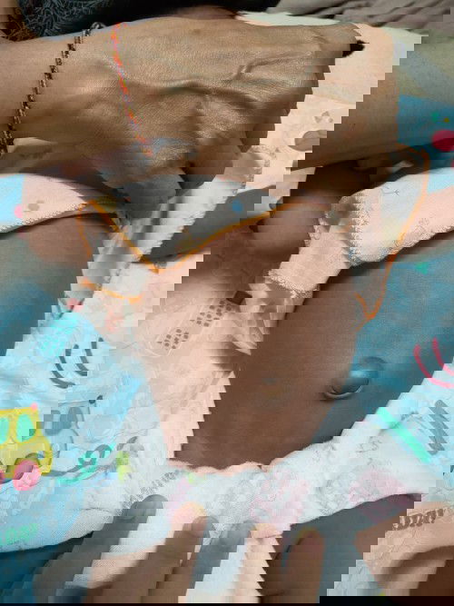 ท้องโตแบบนี้ปกติมั้ยคะ