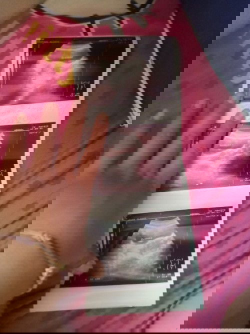 แท้งรึป่าวค่ะ