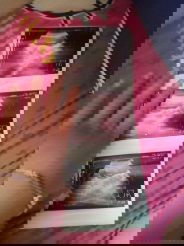 แท้งรึป่าวค่ะ