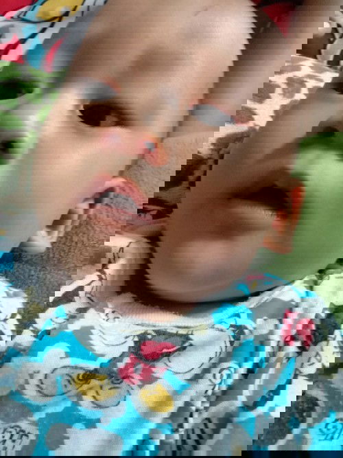 ฟันขึ้นตอนกี่เดือน