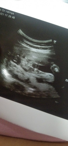 หญิงหรือชายคะ 👶🌹