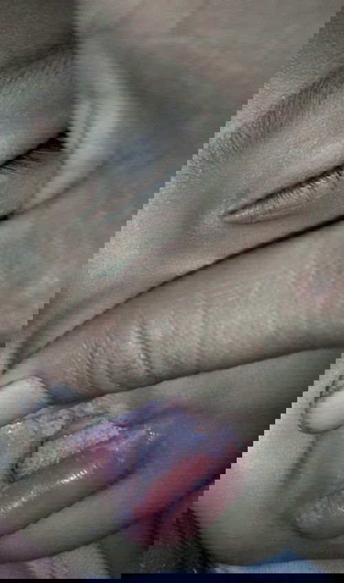 Mulut baby 9 bulan banyak putih2