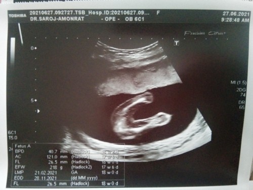 ดูไ่ม่เป็นค่ะ