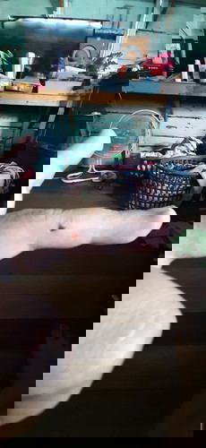 KAGAT NG PUSA HABANG BUNTIS pero meron na akong 1st shot ng anti tetanous Safe na po ba yon.