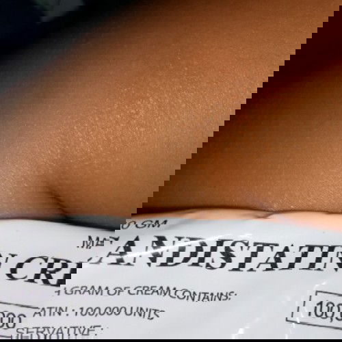 Adakah ini ringworm.