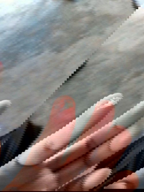 พอดีท้องได้8เดือนแล้วมีก้อนขาวๆแบบนี้ออกมาขณะที่ฉี่