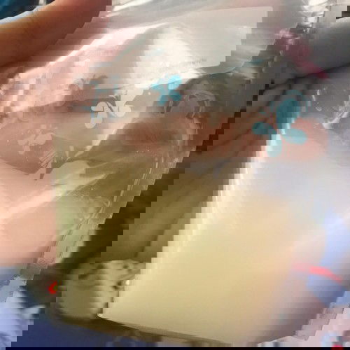 น้ำนมส่วนหน้า น้ำนมส่วนหลัง