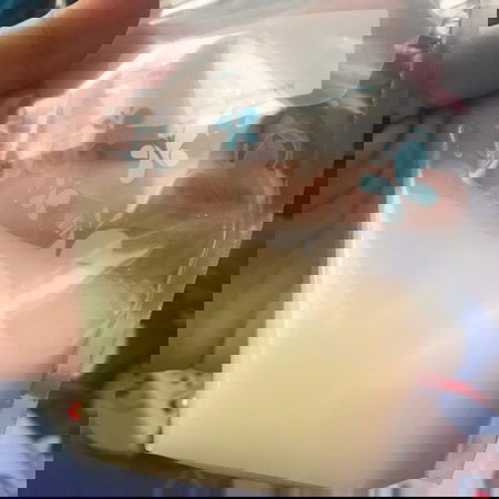 น้ำนมส่วนหน้า น้ำนมส่วนหลัง