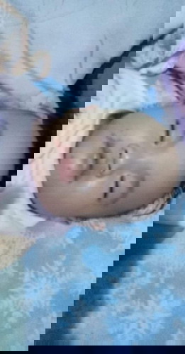 Singaw ng baby