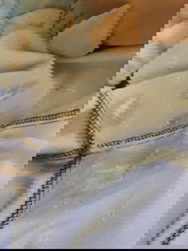 แบบนี้ควรทำไงคะแม่ๆ