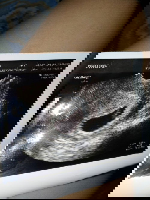 ขอถามแม่ๆคะว่าตั้งครรภ์กี่สัปดาห์ถึงจะเจอหัวใจน้องเต้นค่ะ