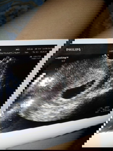 ขอถามแม่ๆคะว่าตั้งครรภ์กี่สัปดาห์ถึงจะเจอหัวใจน้องเต้นค่ะ