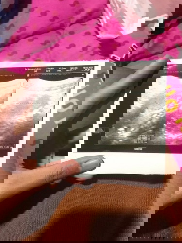 ตรวจเจอ2ขีดแต่ซาวไม่เจอ