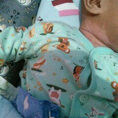 Ruam dileher lama hilangnya dr usia 3 bln smpe hmpir usia 4 bln..