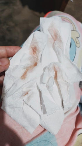 Light Vaginal Bleeding