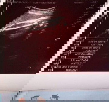 แบบนี้ชายหรือหญิงค่ะแม่ๆ