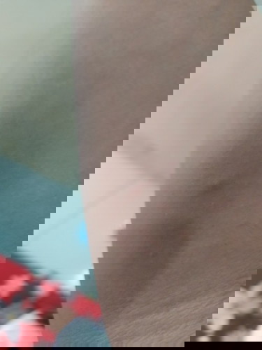 Ibu menyusui digigit kelabang. Bolehkah tetap menyusui.