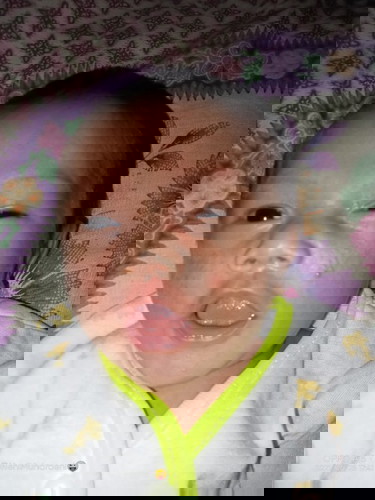 Mau tanya dong Bun obat buat muka bayi yang beruntusan apa ya ๐