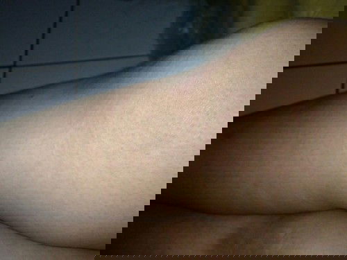 Sudah 2 hari ini saya biduran...sangat gatal mengganggu stres.... 
Solusinya apa yya? Mohon infonya