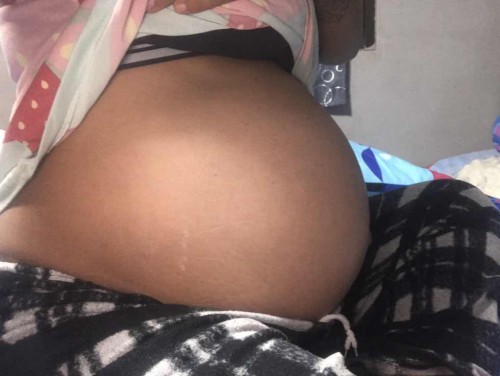 36+5 อยากแตกแล้วค่ะ ปวดมวนๆท้อง
เดินไม่ไหวแล้วค่ะ ปวดจิมิ ลุกก็โอย นั่งก็โอย กำหนด22กค.