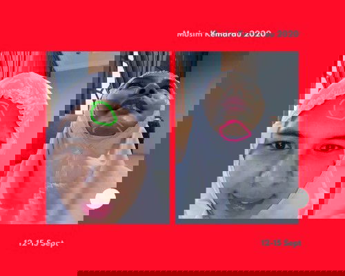 Pengalaman Masa Kecilku