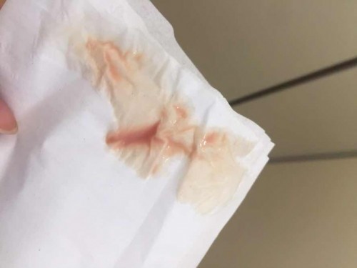 35+2 แบบนี้ปกติไหม