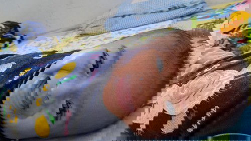 Bercak putih di dahi bayi usia 3 bulan