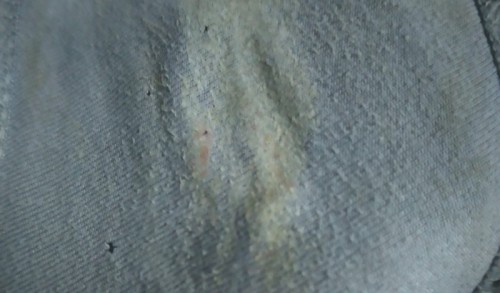 เหมือนมีสีแดงชมพูออกมาจากช่องคลอด 34+5w