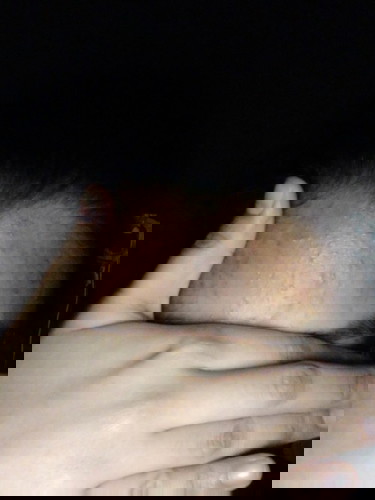 Hi mommy,mcm mana nak hilangkan jerawat ,adakah ni hormon masa pregnant,