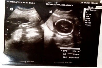 Bantu jawab dong bun