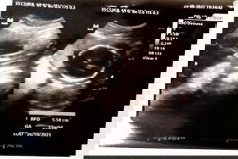 Bantu jawab dong bun