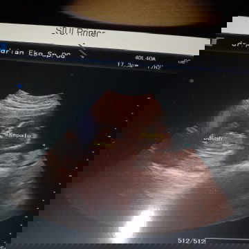 Bersyukur janin masih sehat