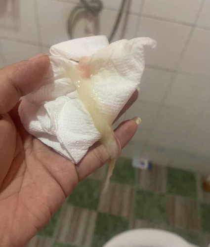 วันนี้ครบ 28 วีค มีอาการปวดท้องน้อยเหมือนมดลูกบีบตัว แล้วเลือดออก