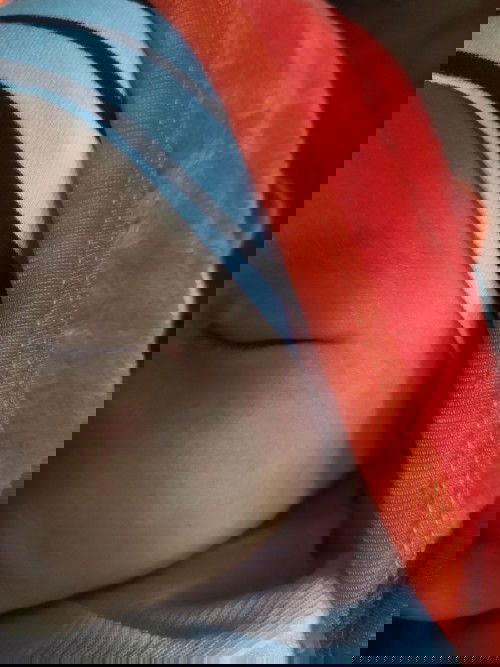 Ruam merah di wajah bayi