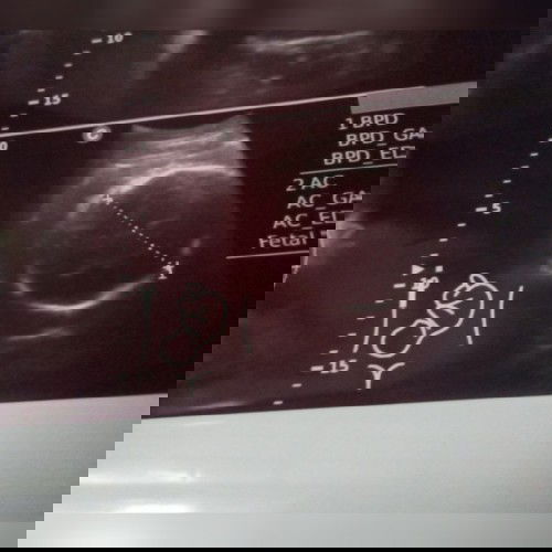 Seputar kehamilan TM3