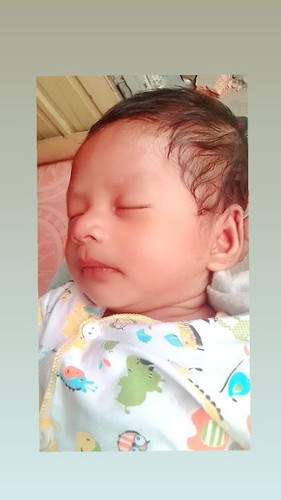 Telat imunisasi bcg ...