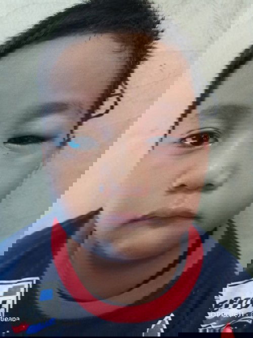 Mata bengkak saat bngun tidur