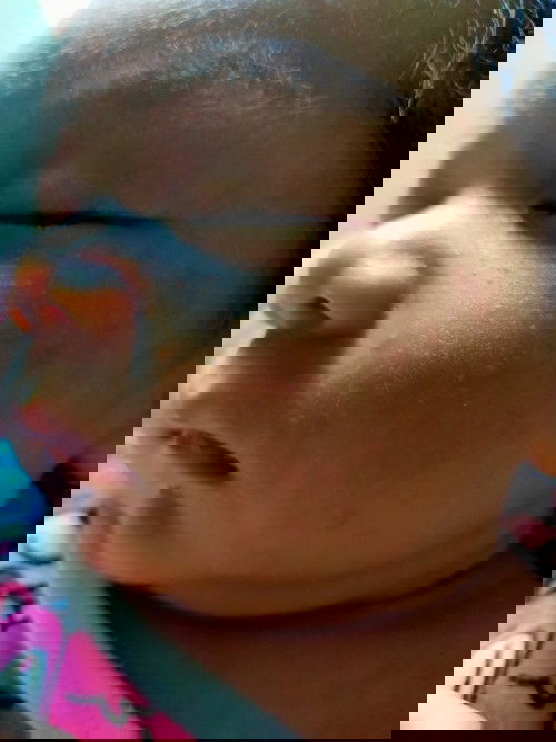 ขอถามแม่ๆหน่อยคะน้องมีผื่นขึ้นแบบนี้ใช้ครีมอะไรทาถึงจะหายคะ