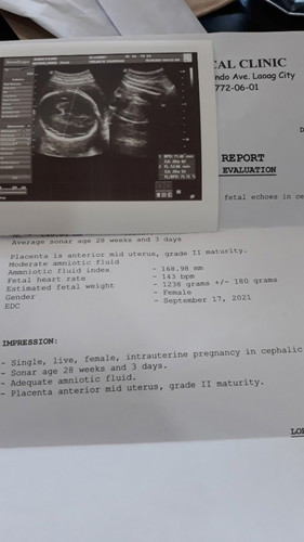 Mid uterus