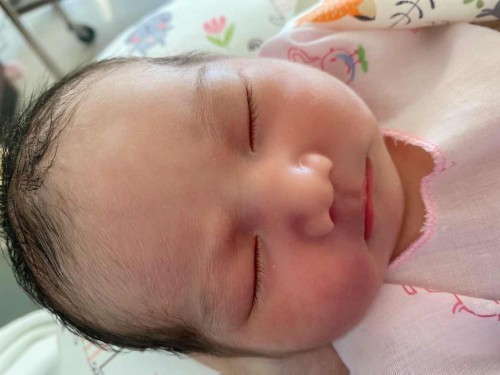 น้องได้12วัน สะดือยังไม่หลุดเลย บ้านไหนหลุดแล้วบ้าง #18มิถุนายน