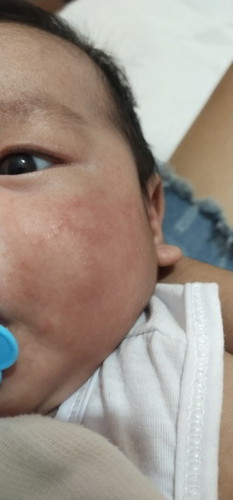 pa advice po mga mamsh