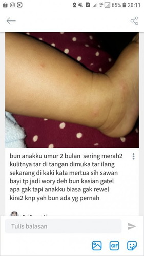 Sawan bayi