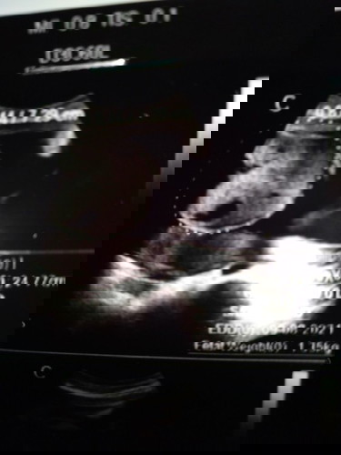 Kata dokternya hasil usg