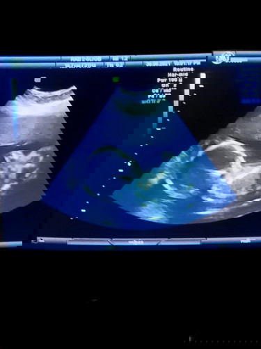 รู้เพศแล้วจ้า