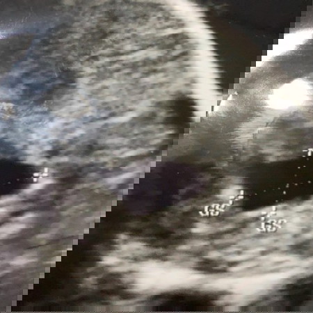 เสี่ยงแท้งไหมคะ