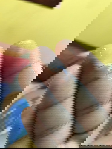 37+2 มูกขาวข้นเป็นน้ำไหลมาไม่มาก