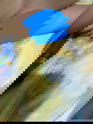 Is this diarrhea?