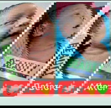 Produk berjuta manfaat bisa untuk skincare dan P3K ya Bun 😊 aman untuk bayi, dewasa, laki perempuan