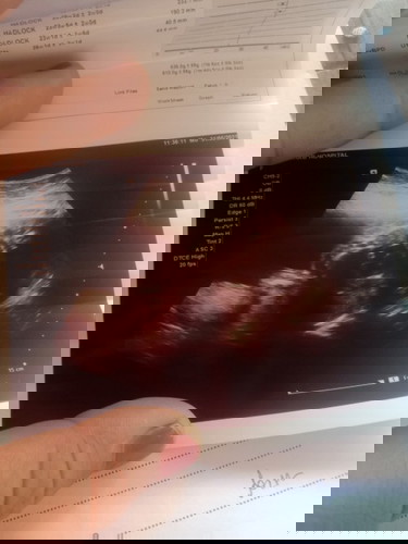 อยากให้แม่ๆช่วยดูหน่อยค่ะ😅